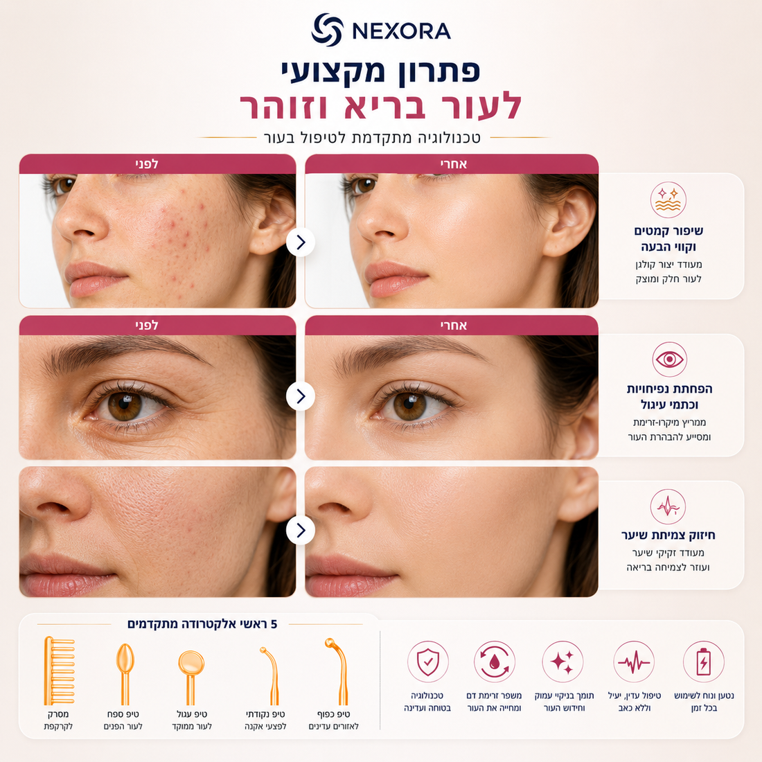 GlowCare Pro – מכשיר טיפול מתקדם לאקנה וחידוש עור